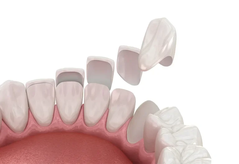 Cosmetic Dentistry