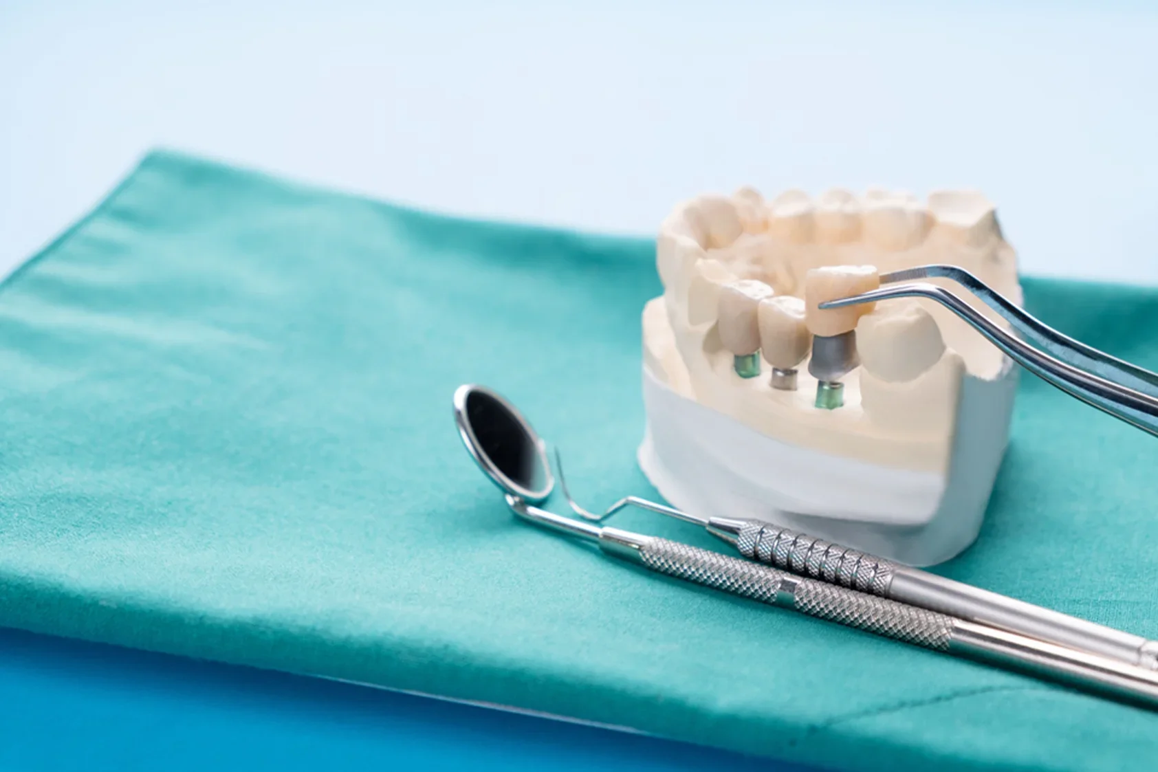 Endodontic Treatment