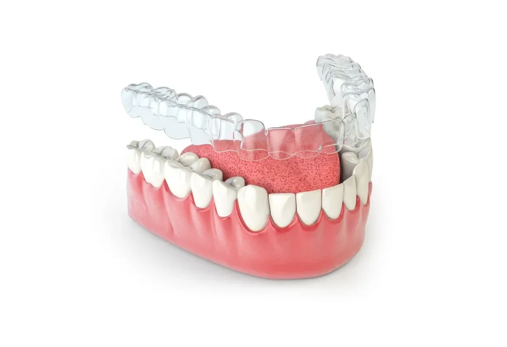 Orthodontics