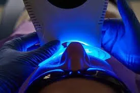 Coollight teeth whitening