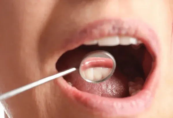 Dental Consultation